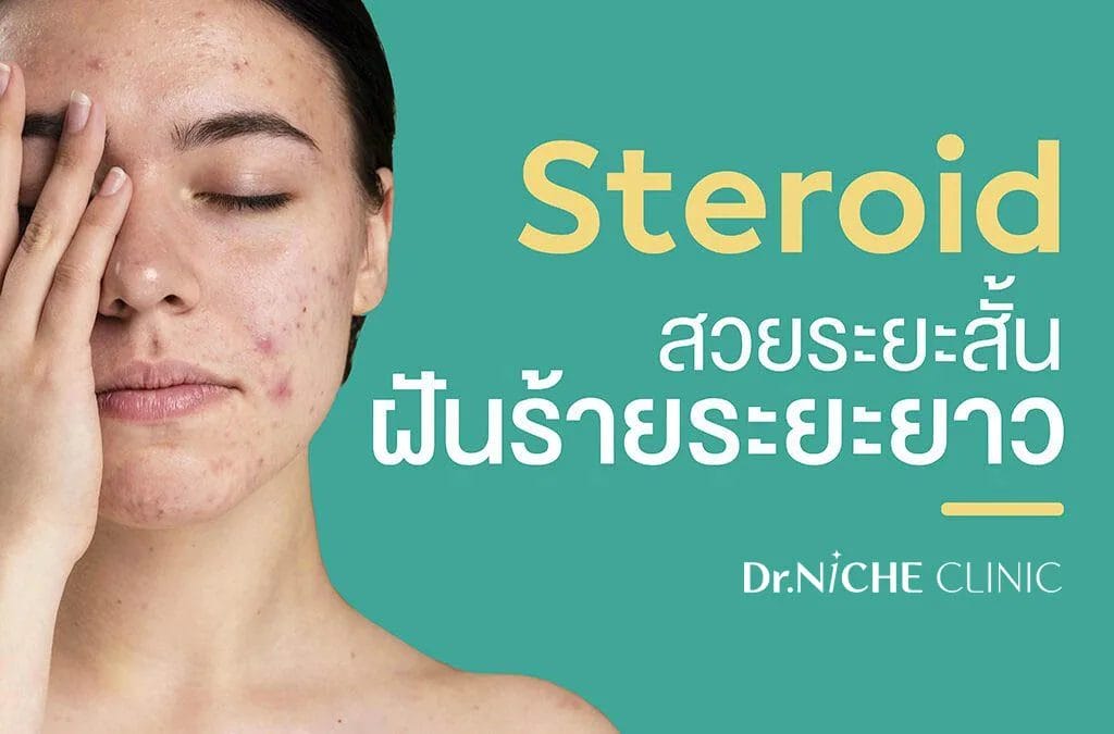 Steroid ผิวติดสาร
