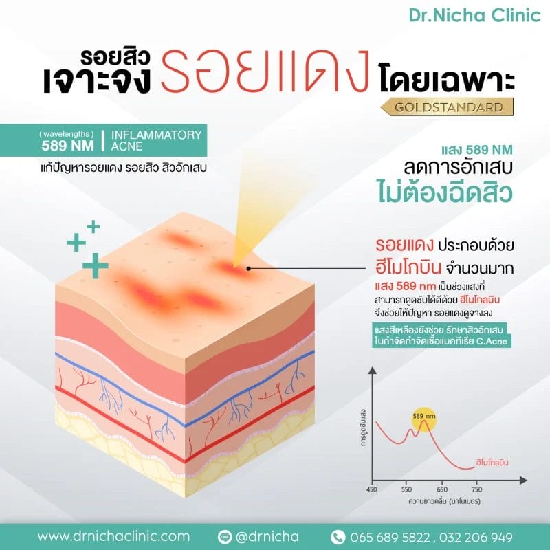 ADVATx รวมArtboard 5 e1646038196280