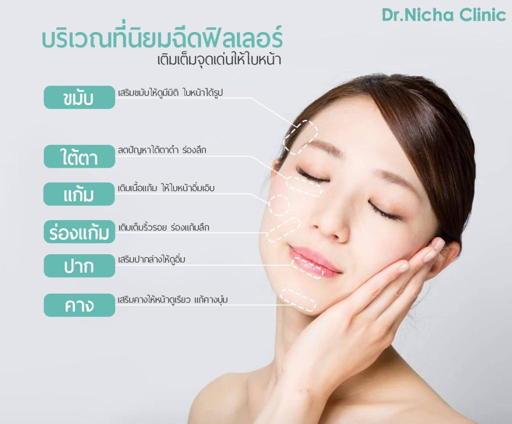 Filler บริเวณไหน filler ฟิลเลอร์ บริเวณไหน