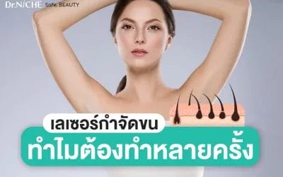 เลเซอร์ขนกี่ครั้งหายถาวร ต้องทำบ่อยแค่ไหน?