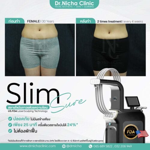 SlimSure Case11 ลดหุ่น