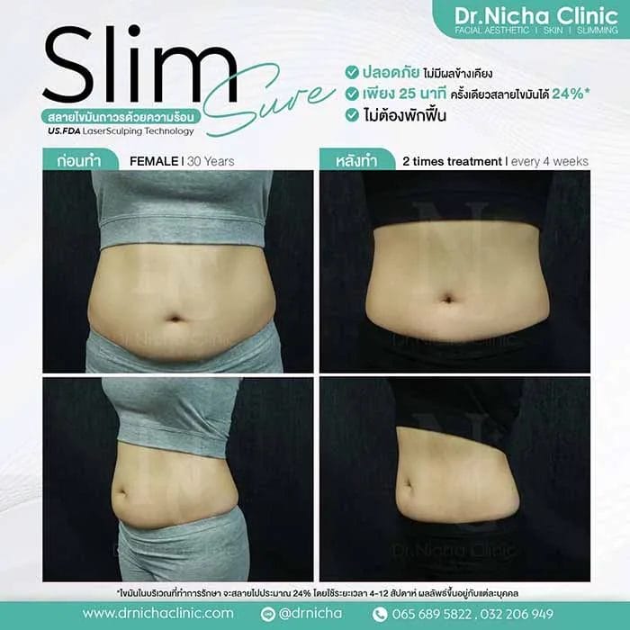 SlimSure Case1 web jpg