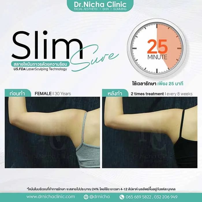 SlimSure Case9 web jpg