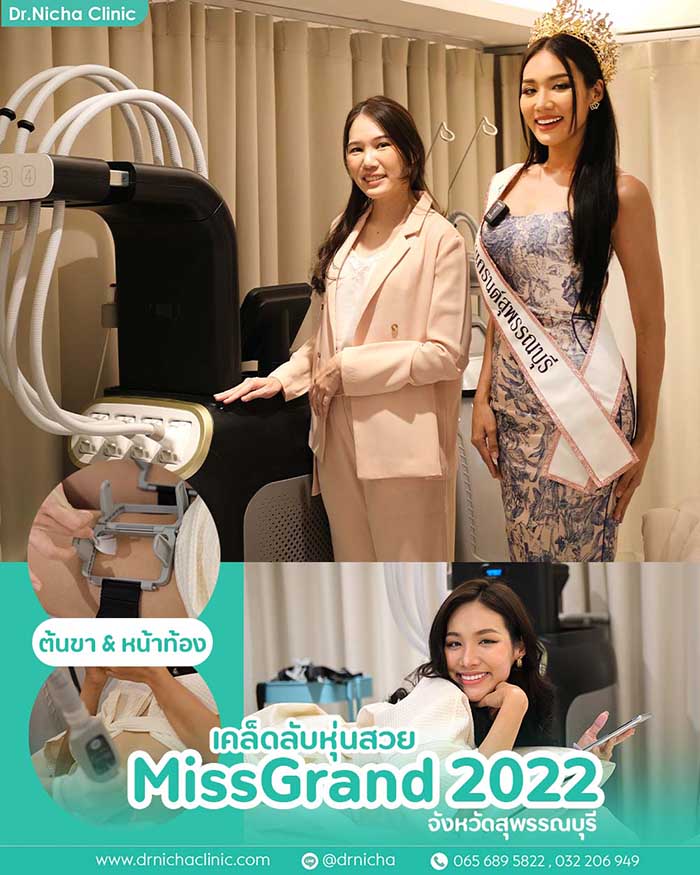 SlimSure สลายไขมัน