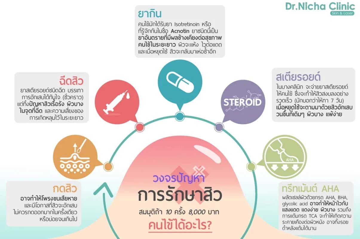 วงจรการรักษาสิว แล้วสิวไม่หาย
