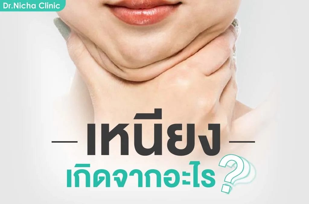 เหนียง เกิดจากอะไร เอาออกยังไง?