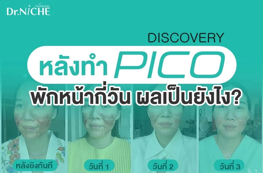 หลังทำ discovery pico พักหน้ากี่วัน รีวิว ผลการรักษา