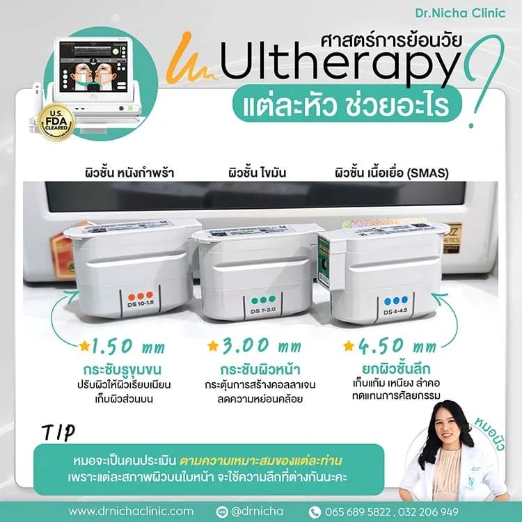 เทียบความลึกการยิง Ulthera แต่ละหัว