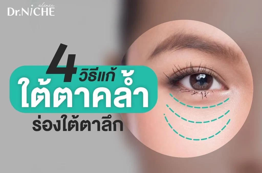 4 วิธีง่ายๆ บอกลาใต้ตาคล้ำ ร่องลึก ทำได้เองที่บ้าน