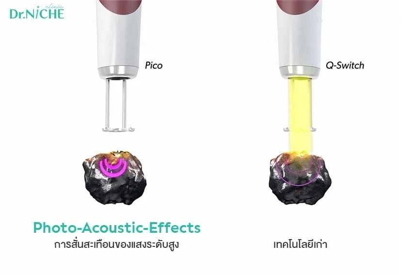Picosecond Laser vs qswitch-1 เปรียบเทียบ picosecond laser กับ q-switch ในการรักษาเม็ดสี