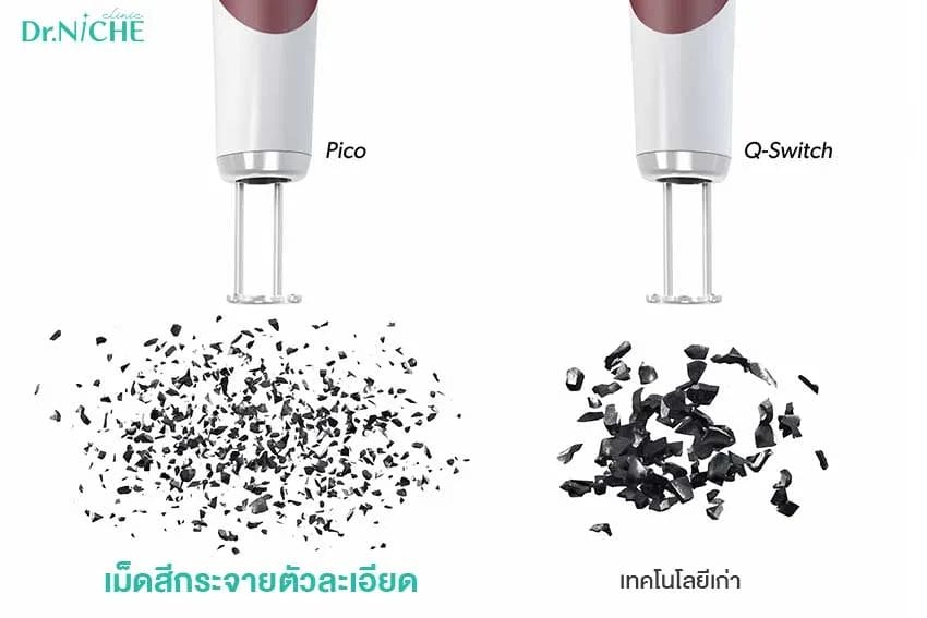 Picosecond Laser vs qswitch-2 Photo Acoustic Effects ของ picosecond laser เทียบกับ q-switch
