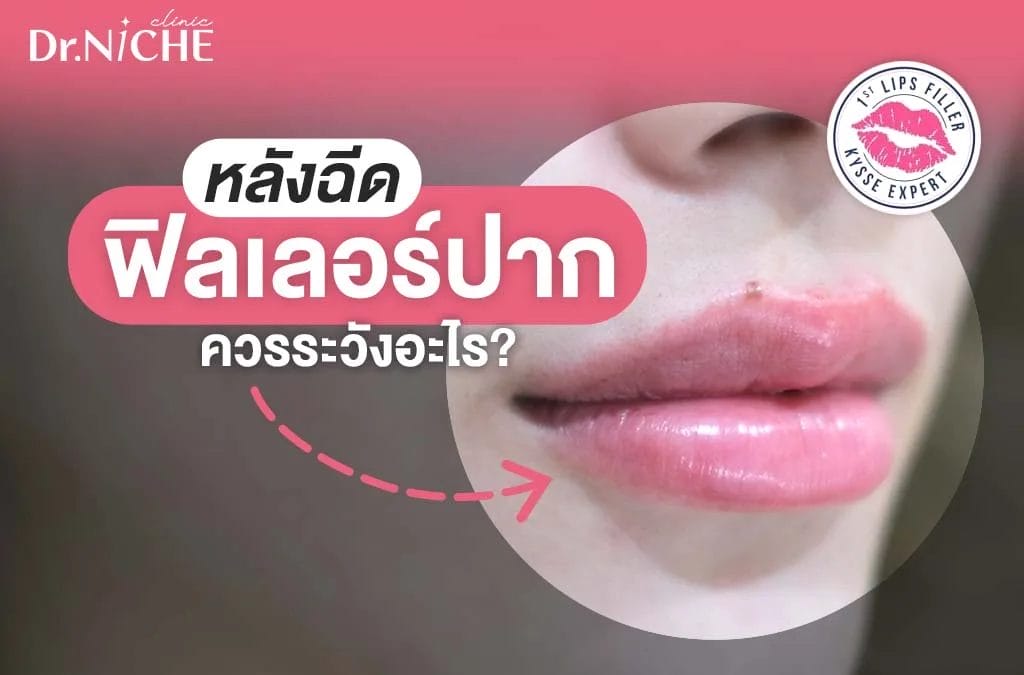 หลังฉีดฟิลเลอร์ปาก ควรระวังอะไร ห้ามกินอะไรบ้าง?