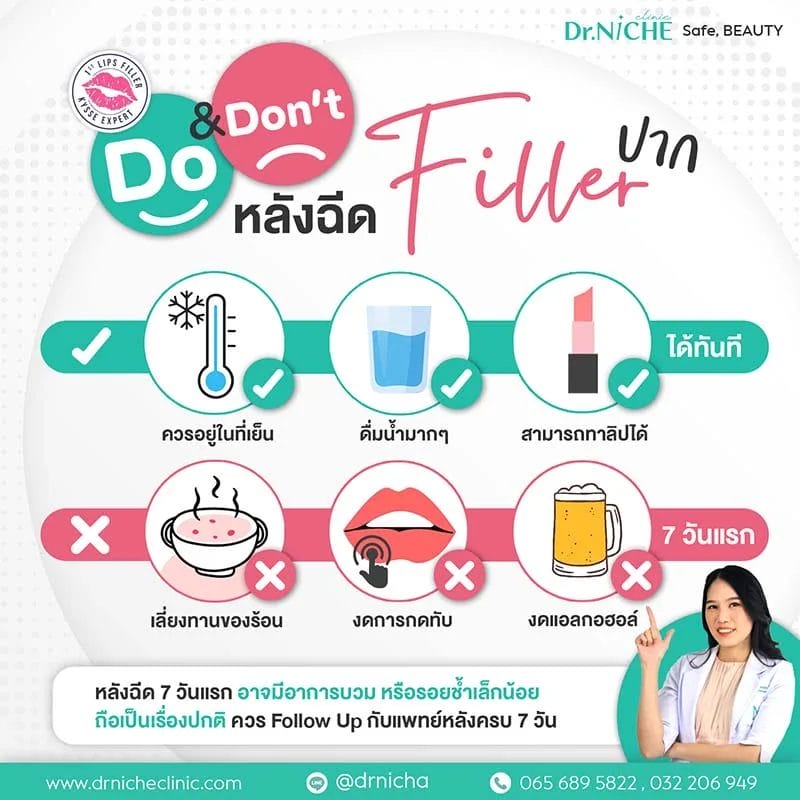 ข้อควรระวังหลังฉีดฟิลเลอร์ปาก