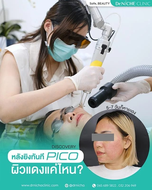 หลังยิง Discovery PICO
