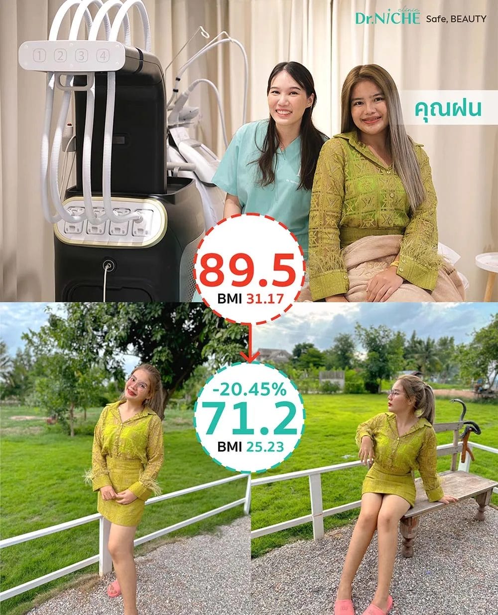ผลการลดน้ำหนัก