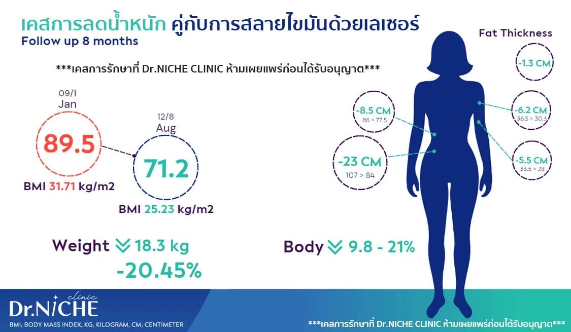 ลดน้ำหนัก ด้วยปากกาลดน้ำหนัก