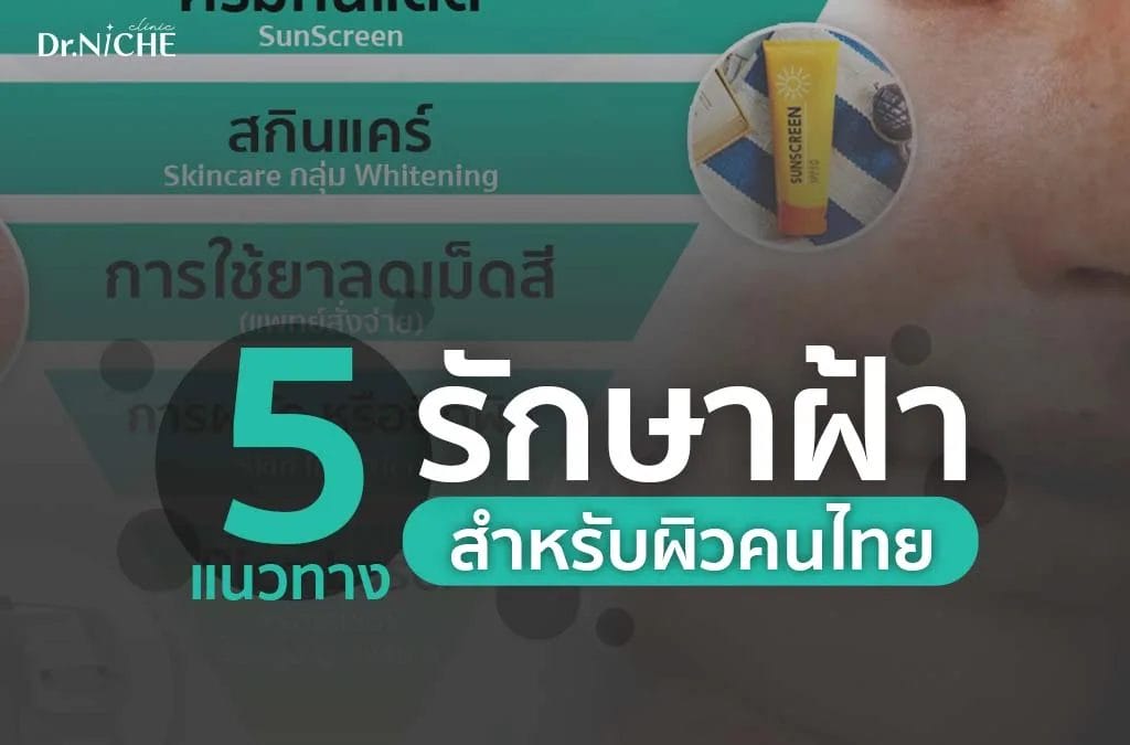 แนะนำ 5 วิธีรักษาฝ้า ที่เหมาะกับผิวคนไทย