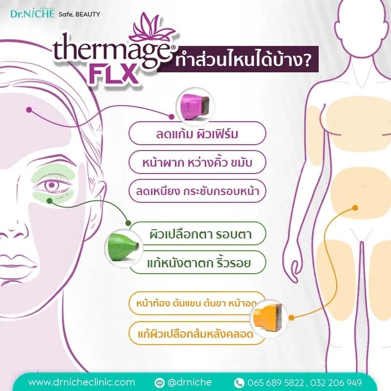 บริเวณที่สามารถทำ Thermage ได้