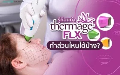 รู้ก่อนทำ Thermage ทำส่วนไหนได้บ้าง เตรียมตัวอย่างไร?