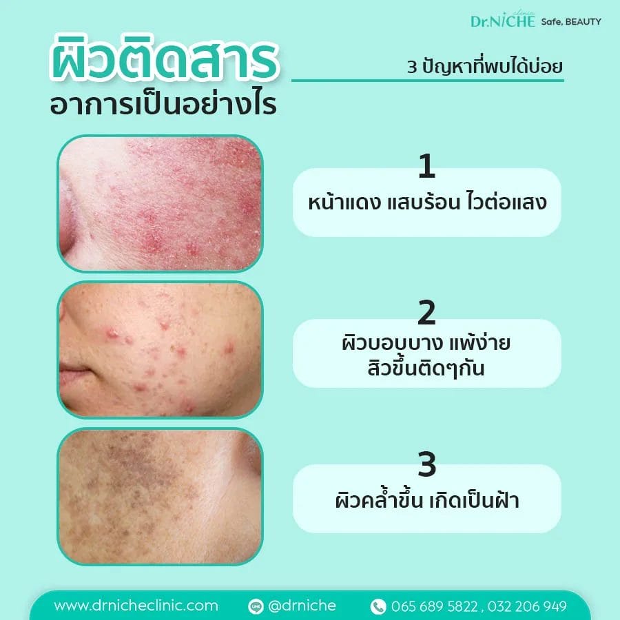 ผิวติดสาร อาการเป็นอย่างไร