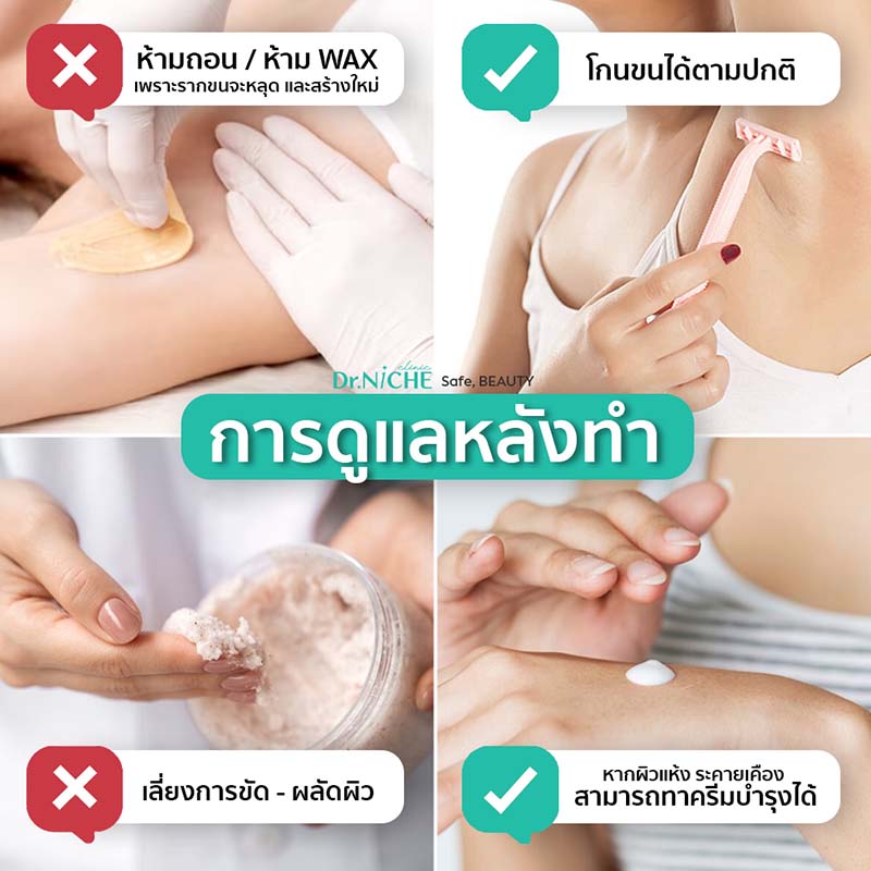 ข้อห้ามหลังการทำเลเซอร์กำจัดขน