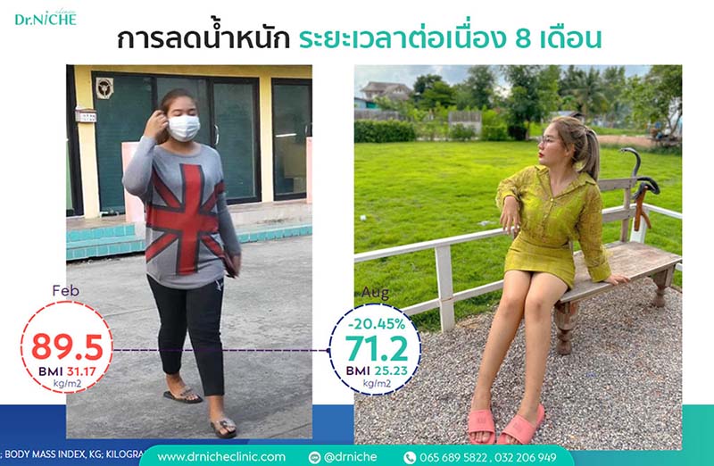 รีวิวลดน้ำหนัก ระยะเวลาต่อเนื่อง 8 เดือน
