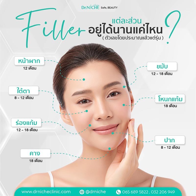 Filler อยู่ได้นานแค่ไหน