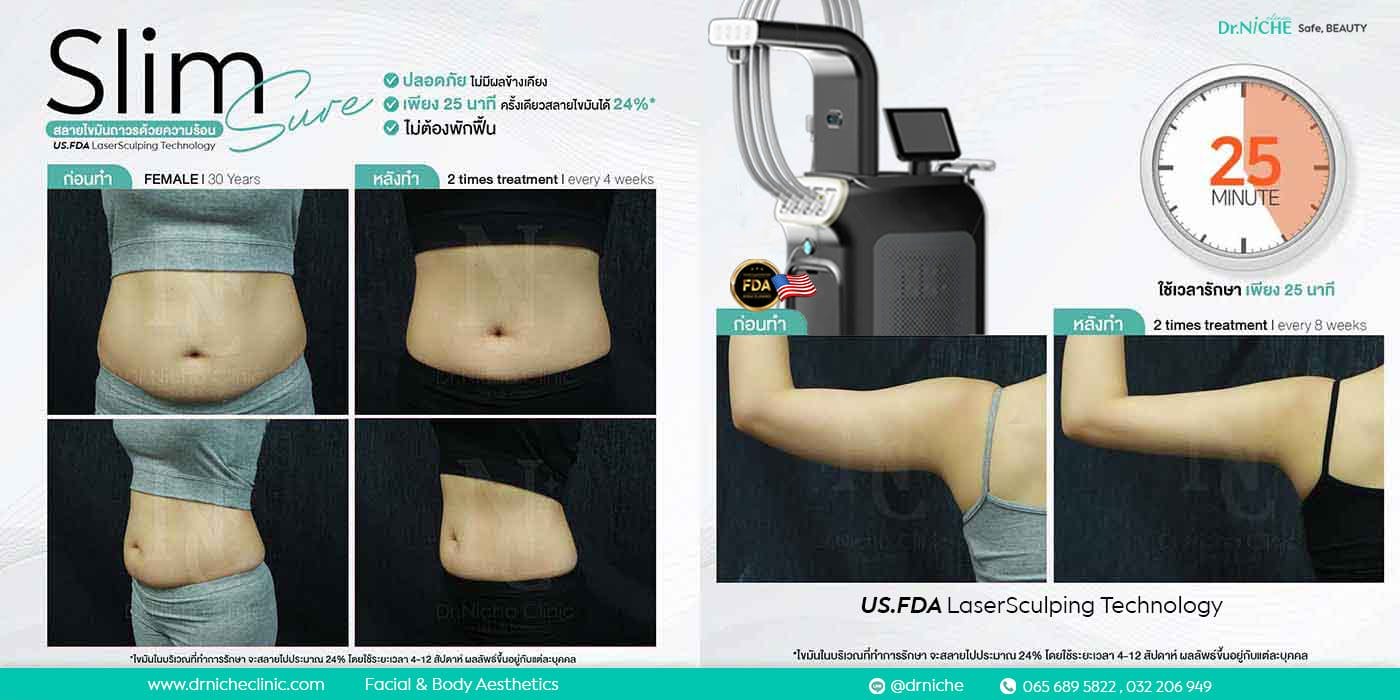 ตัวอย่างเคส คลินิกลดน้ำหนัก สลายไขมัน หน้าท้อง และต้นแขน