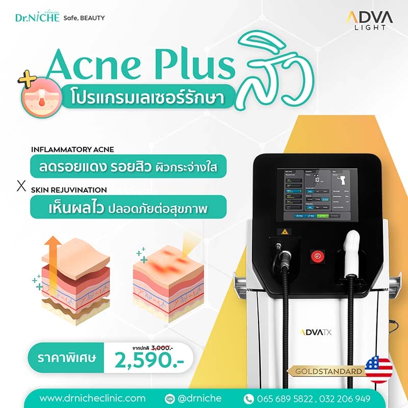 โปรแกรม ACNE Plus by ADVA Light เลเซอร์รักษาสิว
