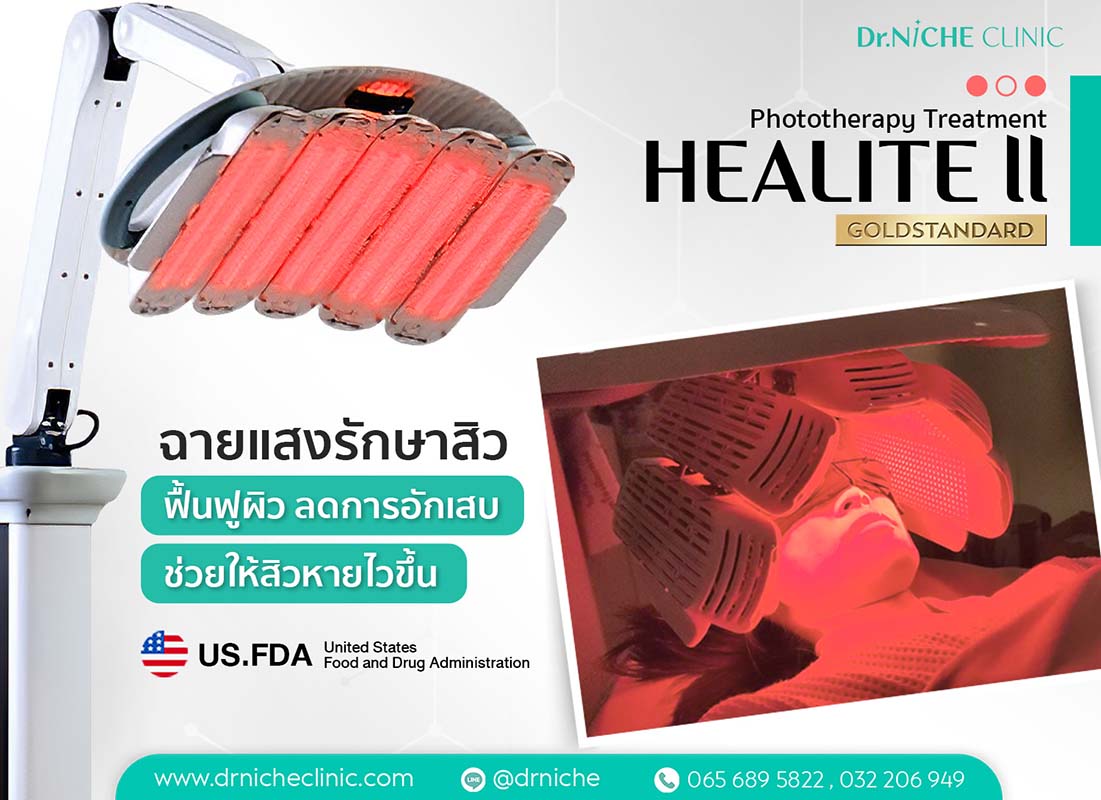 ฉายแสงรักษาสิว Healite II Phototherapy for Acne Treatment