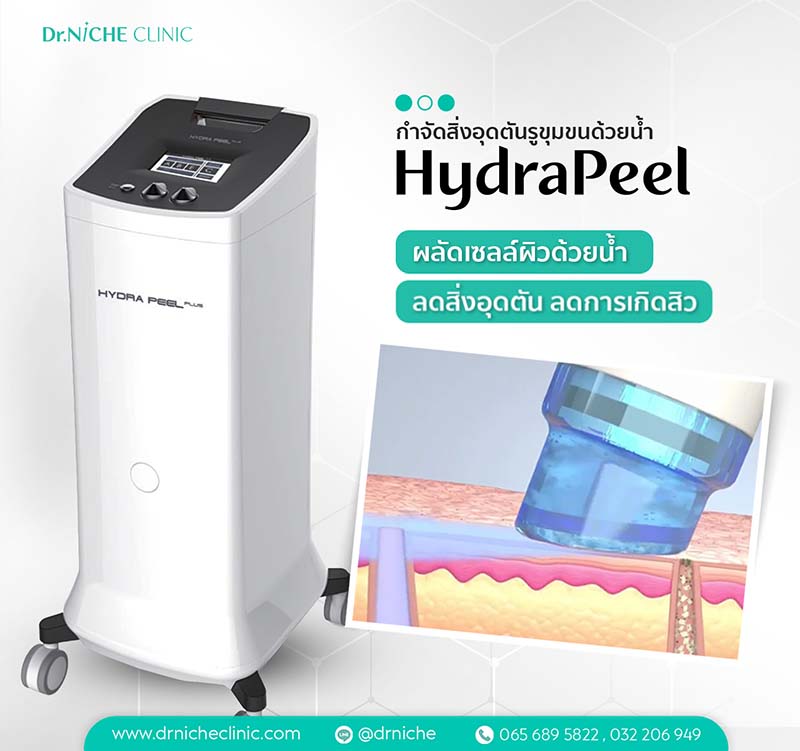 HydraPeel ขจัดสิ่งอุดตัน ลดการเกิดสิวด้วยน้ำ