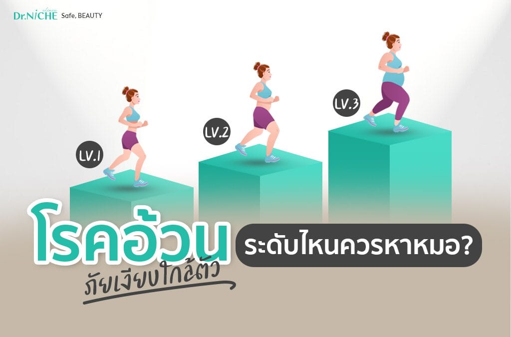 ภัยเงียบของ โรคอ้วน 3 ระดับ แค่ไหนต้องหาหมอ?